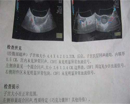 江西女性不孕助孕,江西试管婴儿费用大约多少？附详细江西试管费用及成功率