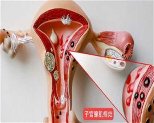 江西代孕代孕中心合法吗,江西三代试管婴儿医院排名怎么样?江西三代试管去