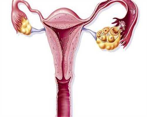 取卵12个老公弱精能配成几个？