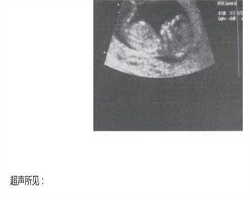 江西辅助代孕网,江西试管婴儿医院/费用/成功率介绍