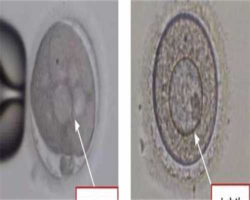 试管移植的最佳内膜厚度是多少-试管移植的最佳内膜厚度是多少？15mm适合移植