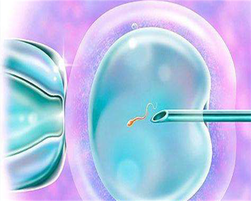 子宫肌瘤：警惕潜在危害，学会科学治疗