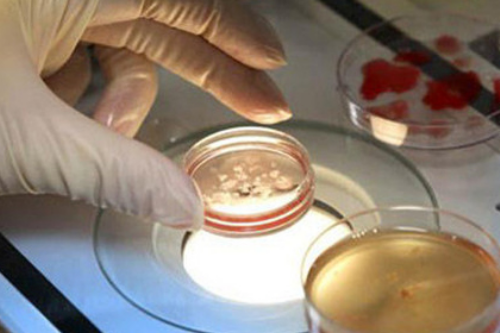 胚胎移植后反胃恶心不是件好事,着床不成功是其原因之一