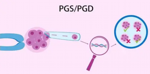 江西代生孕母，江西供卵试管中心：江西上饶做试管婴儿选择哪一代好？