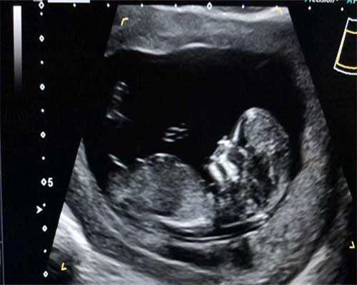 江西公益捐卵,江西供卵试管中心:江西上饶做试管婴儿选择哪一代好?