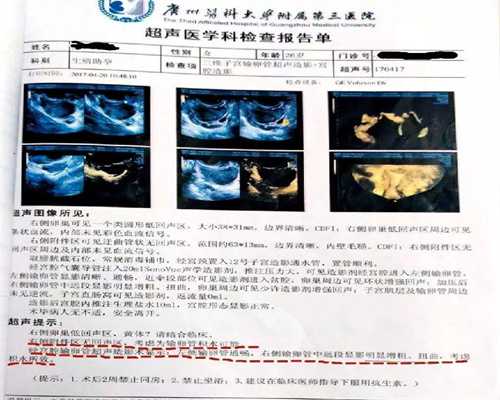 江西代生母亲咨询，江西陪产假有几天