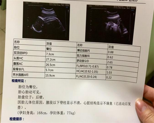 三天的12细胞二级胚胎移植后容易着床成功吗?