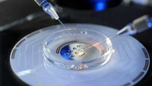 江西代孕服务的方式,俄罗斯试管婴儿供精服务中心(靠谱泰国试管婴儿供精服务