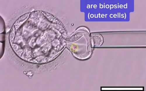 苏州试管供卵试管(苏州供卵试管哪里做)