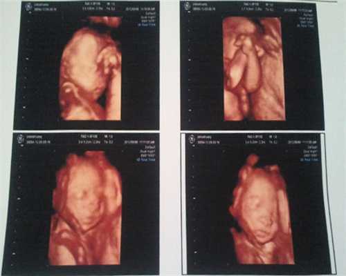 江西试管三代助孕生男孩机构排名，附费用明细！