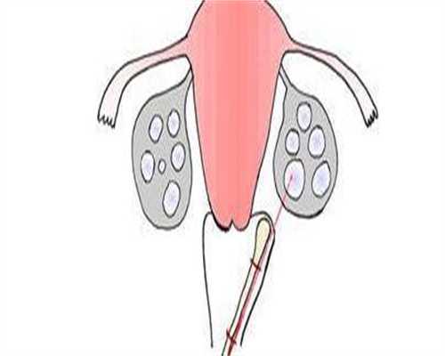 江西借卵生子合法吗,去泰国借卵做试管生子合法吗？