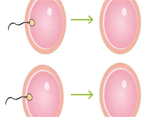 出现宫腔积液如何保胎