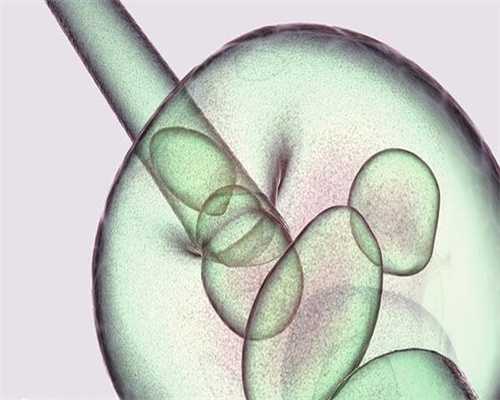 江西私立医院捐卵，江西第三代供卵试管：江西做试管婴儿哪个医院比较好？