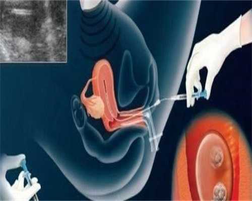 南昌正规供卵试管婴儿,南昌捐卵包生男孩不可信,2026江西18家试管婴儿医院供